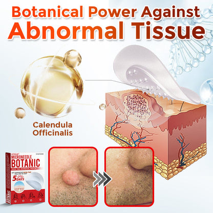 Orthoxiva™ Skin tag removal