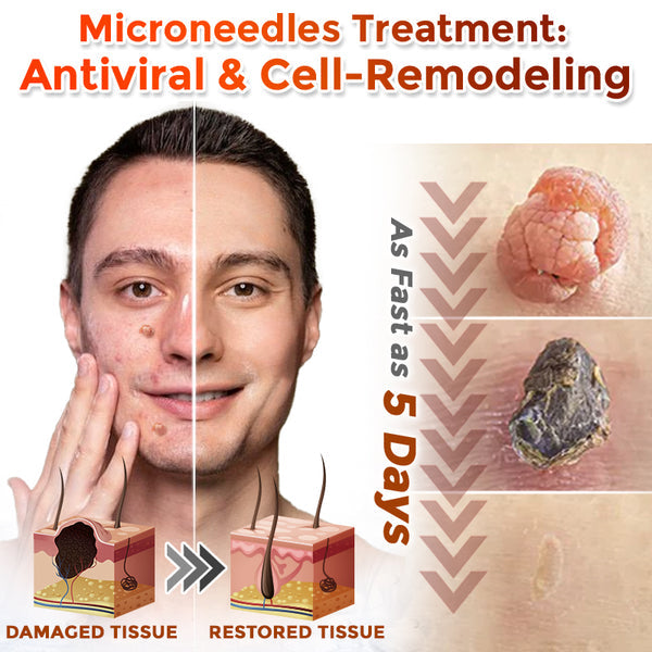 Orthoxiva™ Skin tag removal