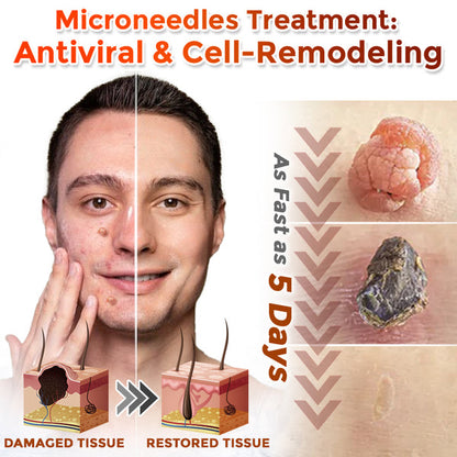 Orthoxiva™ Skin tag removal