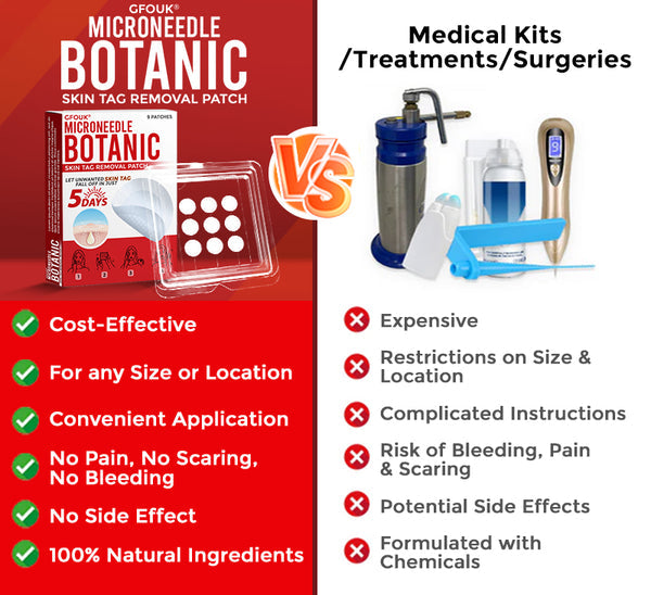 Orthoxiva™ Skin tag removal