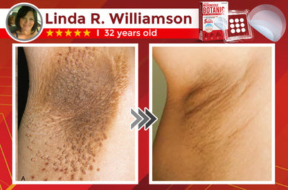 Orthoxiva™ Skin tag removal
