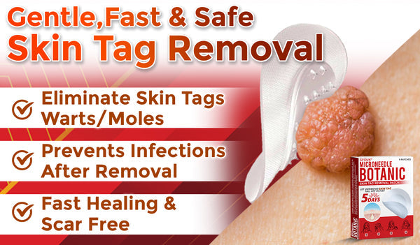 Orthoxiva™ Skin tag removal