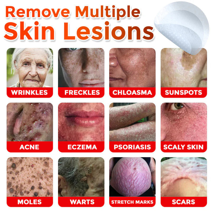 Orthoxiva™ Skin tag removal