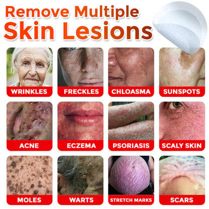 Orthoxiva™ Skin tag removal