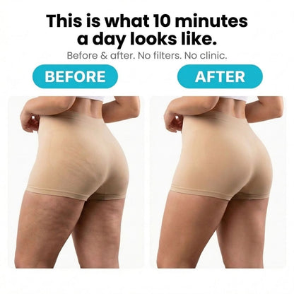 Orthoxiva™ - Anti-Cellulite Rotating Massager